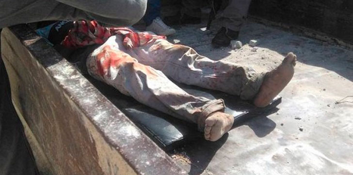 Pasciente-camion-basura