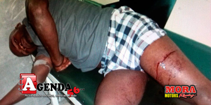 Haitiano-herido-atraco