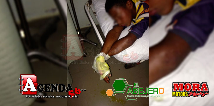 Mano-quemada-niño-Castillo1