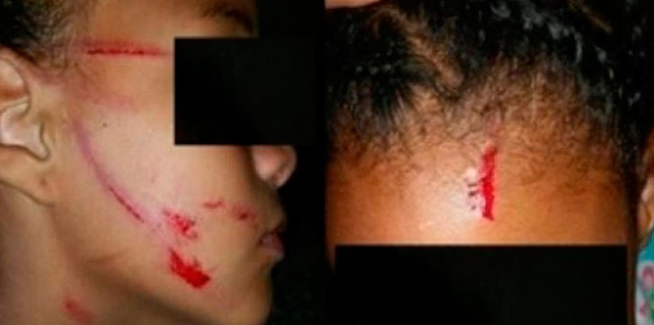 Niña-agredida-escuela