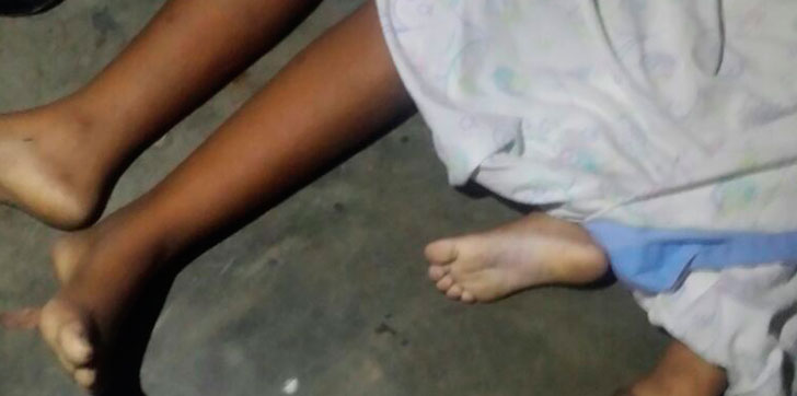 Hermanitas-accidentadas