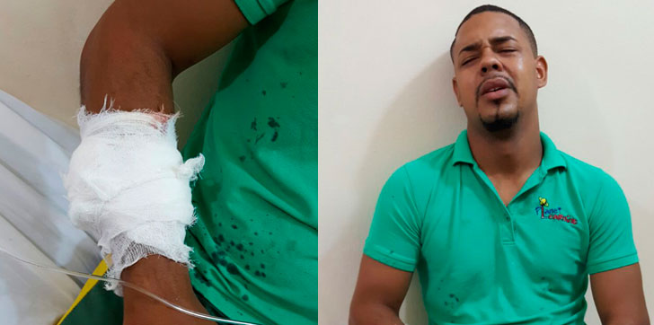 Herido-atraco-Salcedo