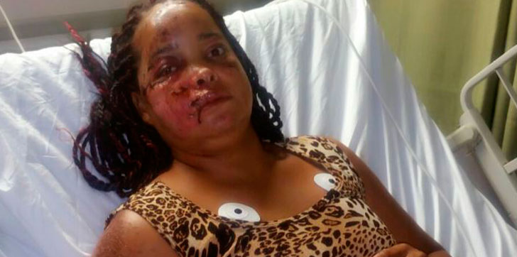 Juana-Castillo-hospitalizada