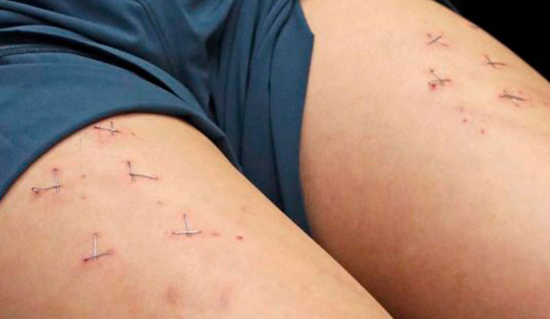 activista-torturas-a-messi