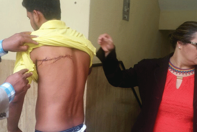 dos-jovenes-terminan-herrido