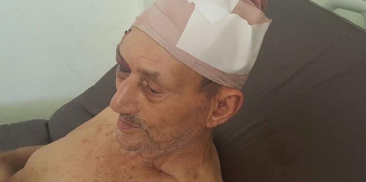 Hieren-anciano-durante-atraco