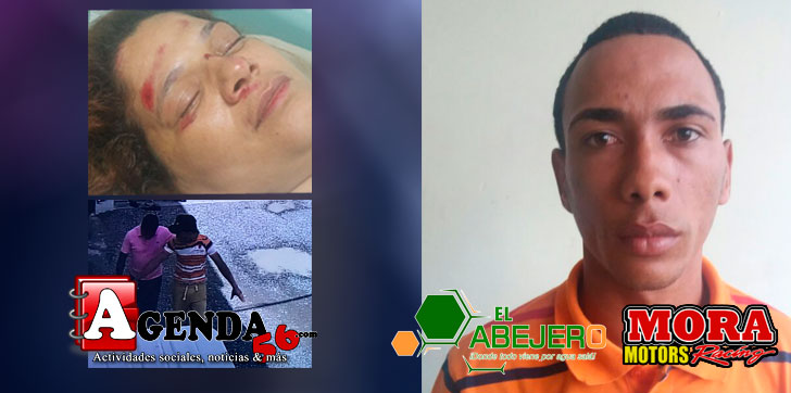 Caso-heridas-de-mujer