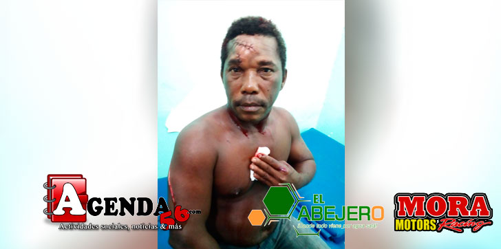 Herido-machetazos-Barranquito