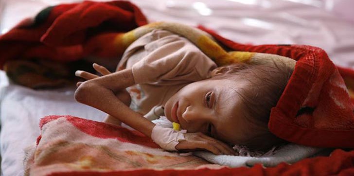 130-niños-mueren-cada-dia-en-yemen