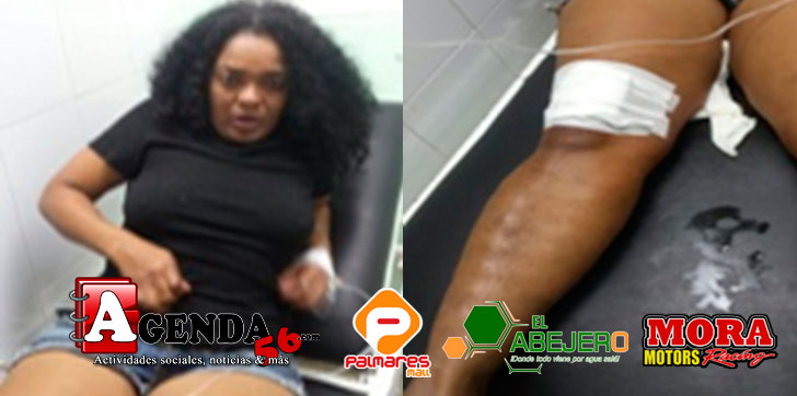 Herida-bala-perdida-SFM