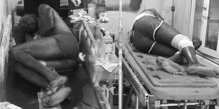 HAITIANOS-HERIDOS-COTUI