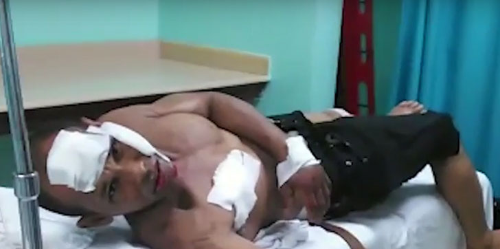 Herido-accidente-Pimentel