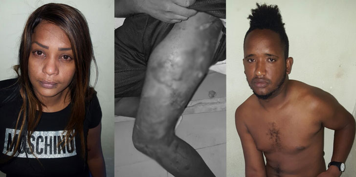 Herido-celos-samana