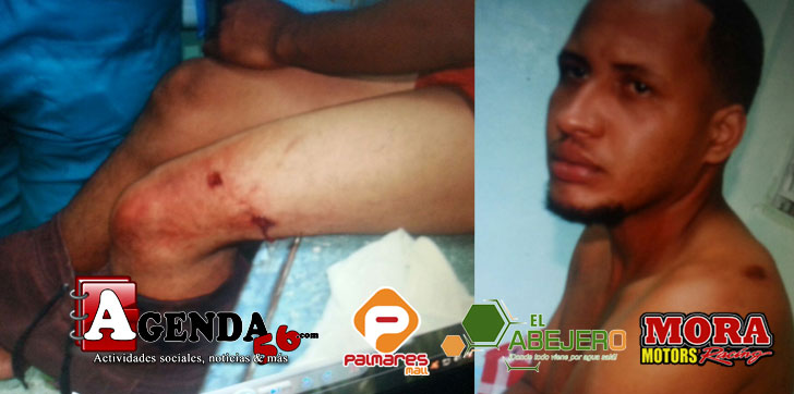 Herido-por-la-policia