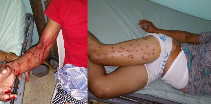 Heridos-perdigones-Navarrete