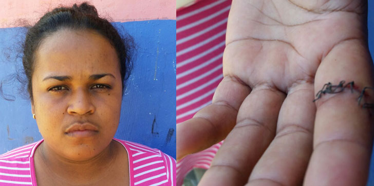 Mujer-herida-Cabrera