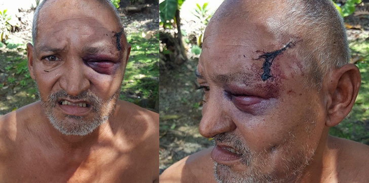 Viejo-pedrada-Castillo