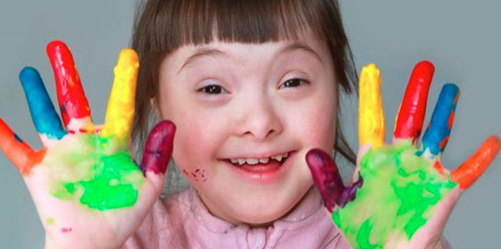 este-miercoles-se-celebra-el-dia-down