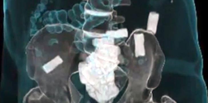 sentencian-dominicano-cargar-27-bolsas-de-heroina