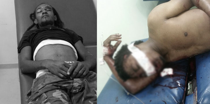 Herido-muerto-Samana