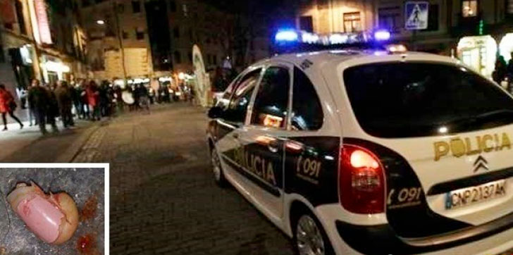 preso-le-mocha-un-dedo-a-policia