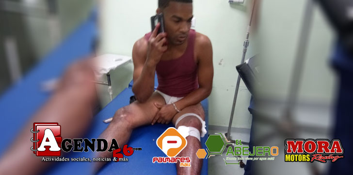 Herido-atraco-samana