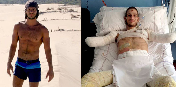 amputan-a-italiano-los-brazos