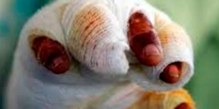 hombre-muere-porgasolina