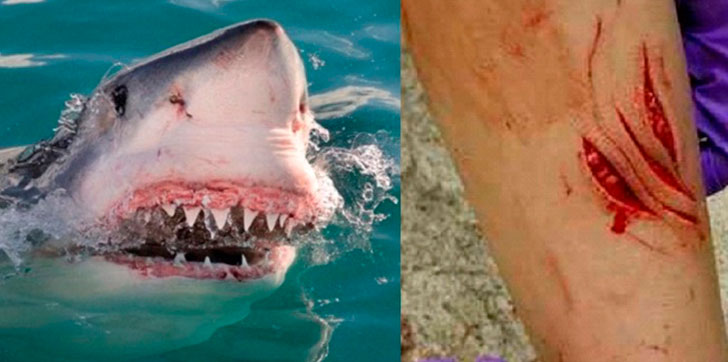 tiburones-atacan-dos-menores