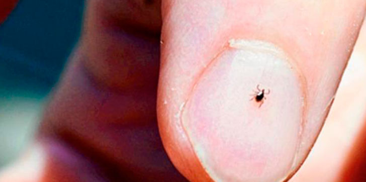 muere-un-hombre-por-la-picadura-de-una-garrapata