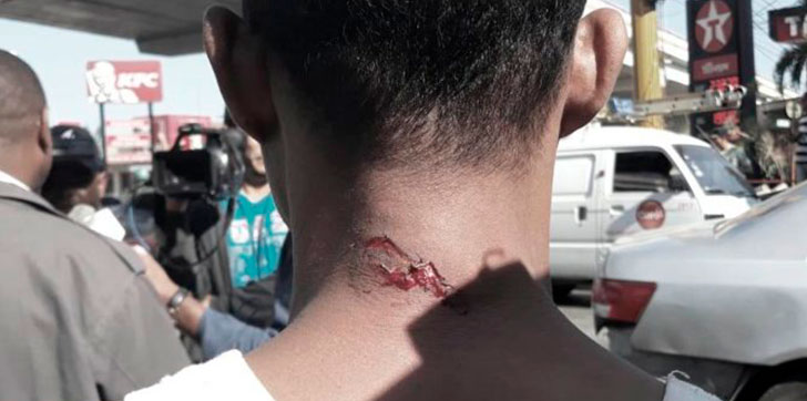 al-menos-ocho-heridos