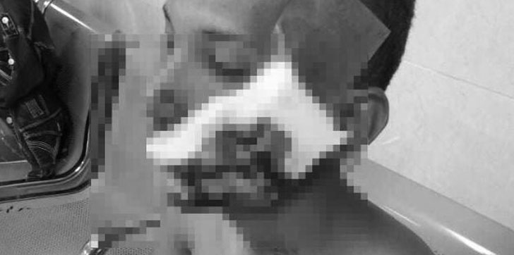 HERIDO-BOTELLAZO-NAVARRETE