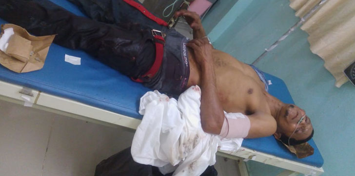 DELINCUENTE-MACHETAZO