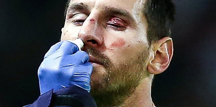 messi-bañado-en-sangre