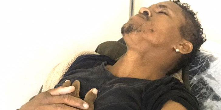 HERIDO-ACCIDENTE-BANI