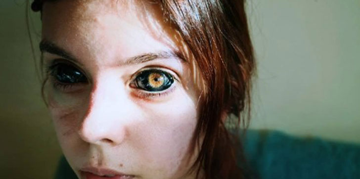 joven-a-punto-de-quedar-ciega