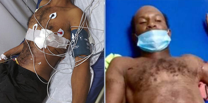 muere-hombre-de-una-puñalada