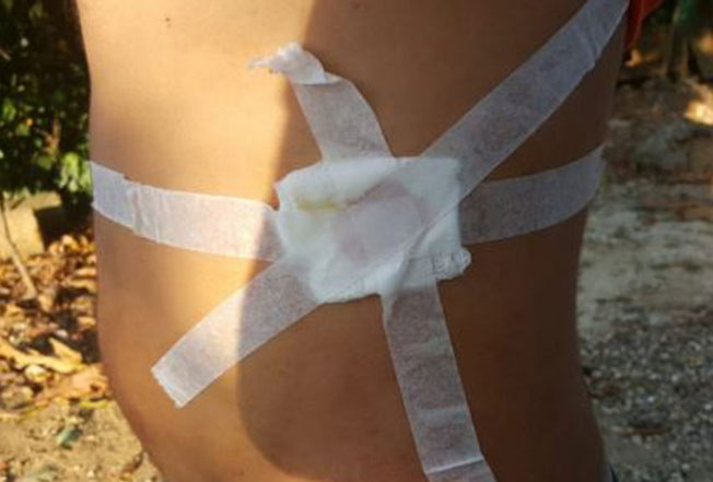 mujer-le-propina-puñalada-a-su-pareja