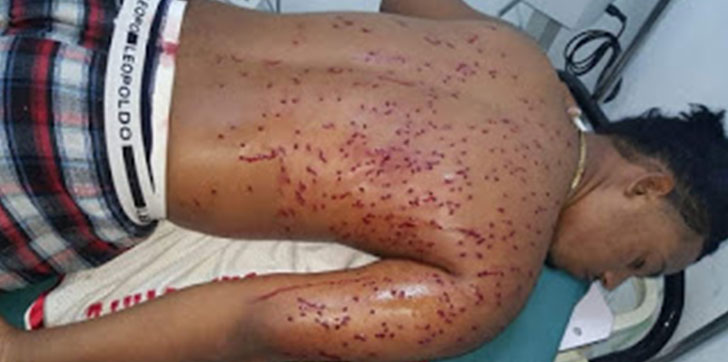 policias-hieren-joven