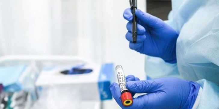 cientificos-identifican-al-tipo