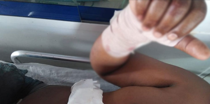 dominicano-resulta-herido