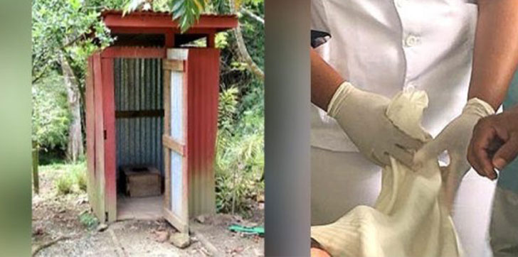 hombre-sufre-quemadura