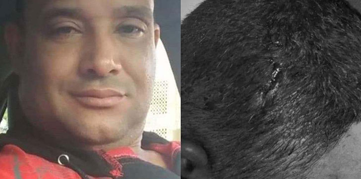 desconocidos-hieren-agente