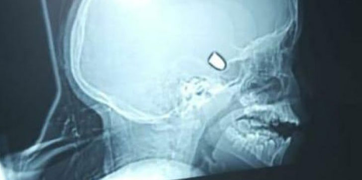 niña-se-encunetra-en-estado