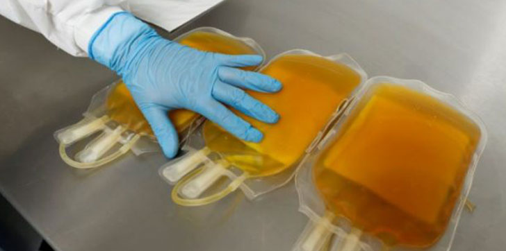 terapia-con-el-plasma