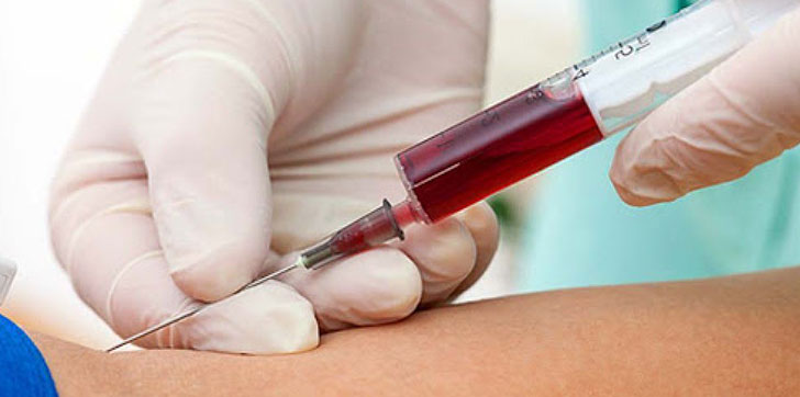 detectan-anticuerpos-covid