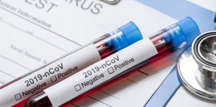 salud-publica-reporta